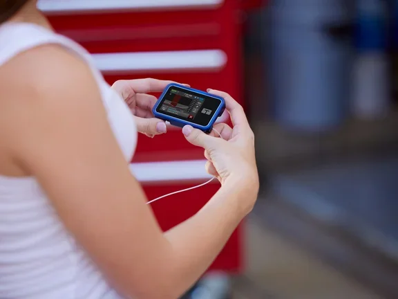 Diabetes Patientin mit der t:slim X2 Insulinpumpe in der Hand