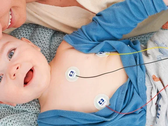 monitoring_Baby mit Kabeln am Oberkörper