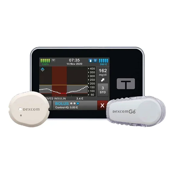 Insulinpumpe Sensoren