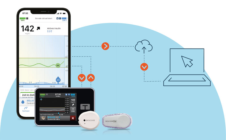 Smartphone und Insulinpumpe Verbindungen zu Tandem Source