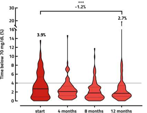 Ein Violin-Plot zur Darstellung der Time below Range ($<70$ mg/dL) über 12 Monate. Der durchschnittliche Zeitanteil im hypoglykämischen Bereich sinkt signifikant von $\text{3,9\%}$ zu Studienbeginn auf $\text{2,7\%}$ nach einem Jahr (Reduktion um $\text{1,2\%}$), was eine verbesserte Sicherheit unter der Therapie zeigt.
