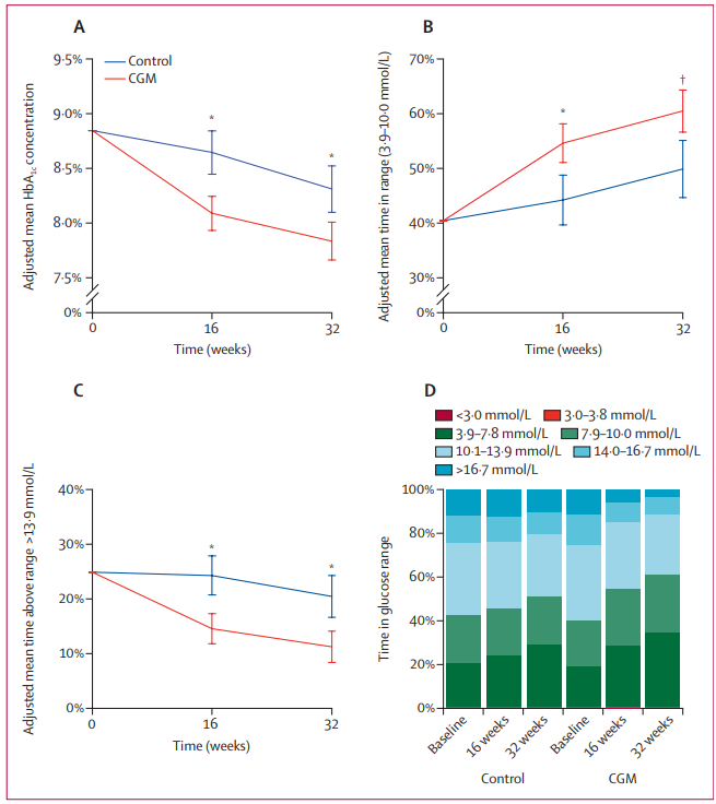 Mehrteilige Grafik zum 32-Wochen-Verlauf von CGM- und Kontrollgruppe. Die Liniendiagramme A–C zeigen mit 95-%-Konfidenzintervallen für CGM eine stärkere HbA1c-Senkung (von 8,8 % auf 7,8 % vs. 8,3 %), einen höheren Anstieg der Zeit im Zielbereich 3,9–10,0 mmol/L (von 40 % auf 60 % vs. 50 %) und eine deutlichere Reduktion der Zeit > 13,9 mmol/L (von 25 % auf 11 % vs. 21 %). Das gestapelte Balkendiagramm D verdeutlicht für CGM die Verschiebung von hyperglykämischen Werten hin zum grünen Zielbereich, während di